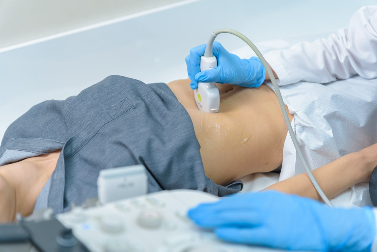 Abdominal ultrasound