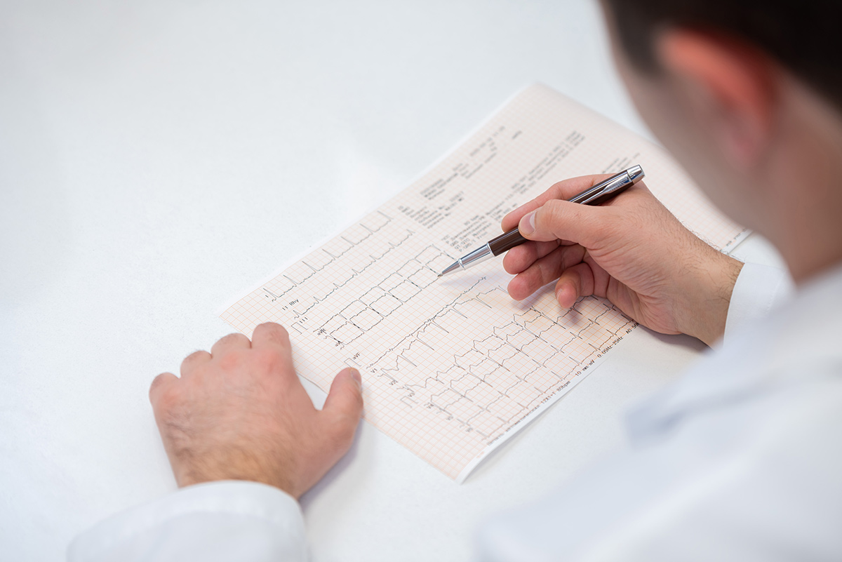 ԷՍԳ (էլեկտրասրտագրություն)