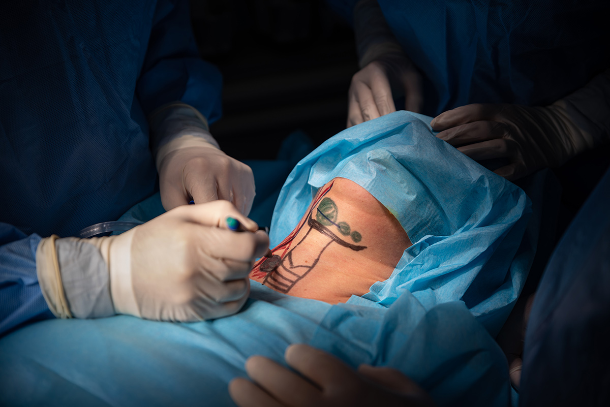 Хирургия шеи и головы в Ереване