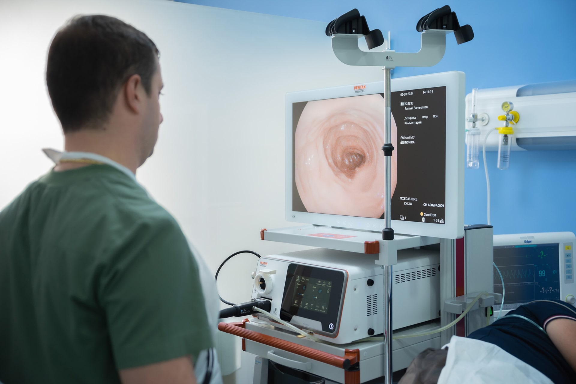 Endoscopy in Yerevan