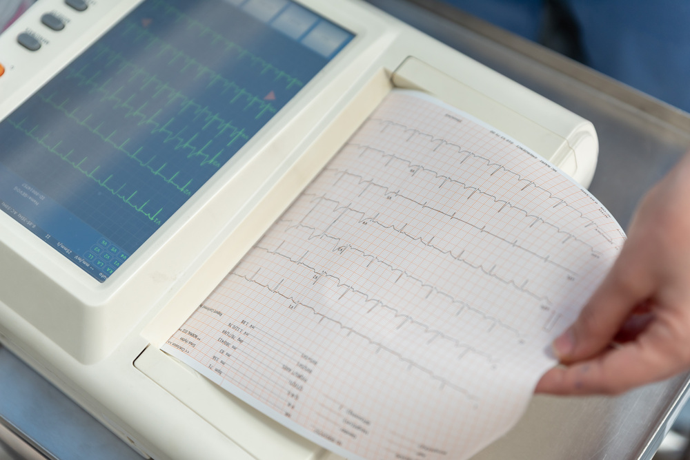 Холтер-мониторинг сердца